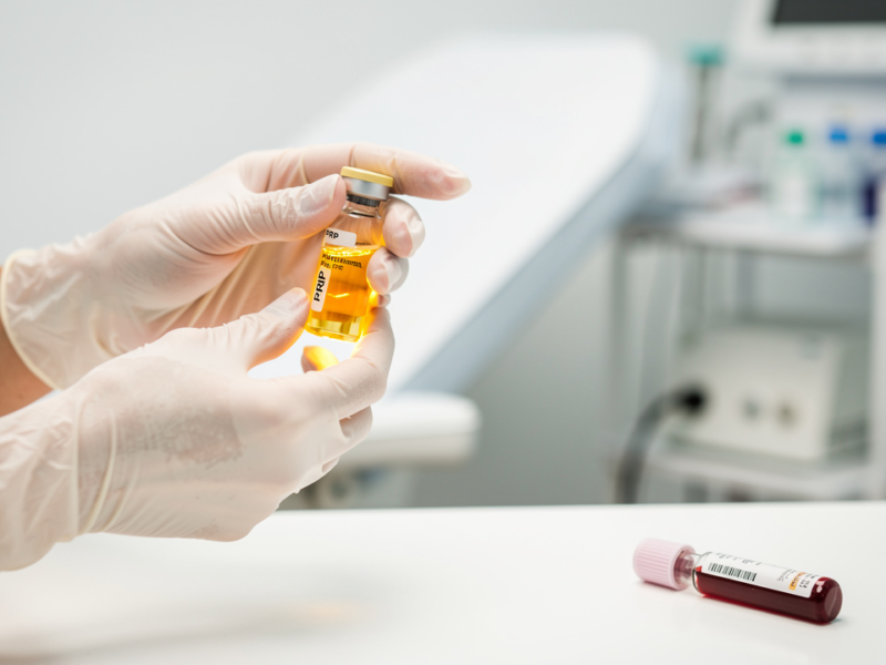 understanding-side-effects-of-prp-treatment-a-comprehensive-guide