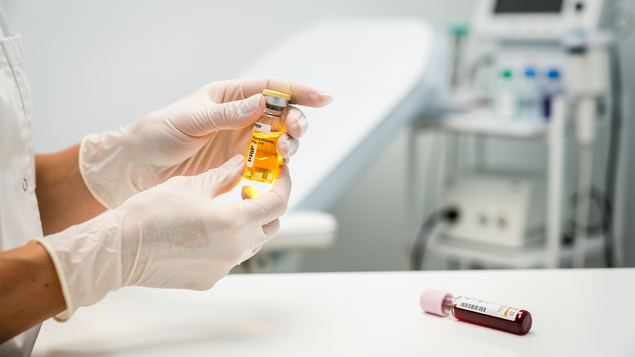 understanding-side-effects-of-prp-treatment-a-comprehensive-guide